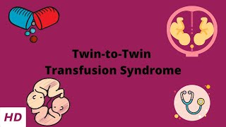 TwintoTwin Transfusion Syndrome [upl. by Kelwunn]