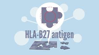 HLA B27 History with Ankylosing Spondylitis [upl. by Kado]