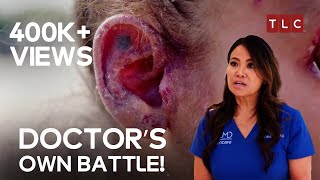 A Dermatologist’s Personal Fight  Dr Pimple Popper TLC [upl. by Ridinger]