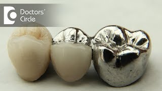 Comparison between Ceramic Porcelain and metal crowns  Dr Aniruddha KB [upl. by Suoirred]