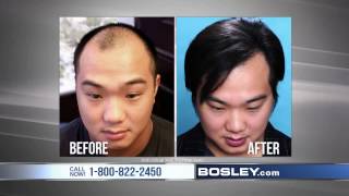 Tired of Losing Your Hair  Bosley Commercial [upl. by Affer]