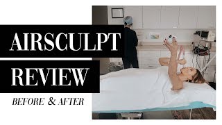 5Month Airsculpt Review  Before amp After [upl. by Ahseral350]