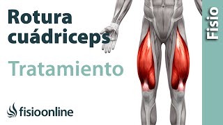 Rotura de fibras del cuádriceps  Tratamiento con ejercicios automasajes y estiramientos [upl. by Macegan]