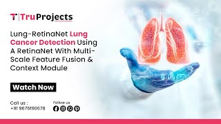 Lung RetinaNet Lung Cancer Detection Using a RetinaNet With Multi Scale Feature Fusion and Context M [upl. by Leuqim]