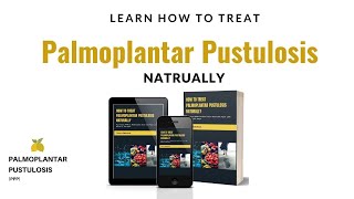 How To Treat Palmoplantar Pustulosis PPP Naturally [upl. by Ettenom]