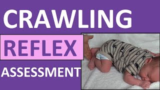 Crawling Reflex Assessment Infant  Newborn  Bauer Reflex  Pediatric Nursing NCLEX [upl. by Enisaj508]