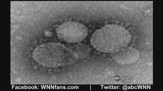 New SARSLike Virus With No Cure Kills at Least 27 [upl. by Ised]