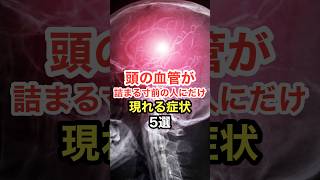 頭の血管が詰まる寸前の人にだけ現れる症状【5選】 長寿命 [upl. by Rutherford428]