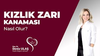 Kızlık Zarı Kanaması Nasıl Olur [upl. by Ayita]