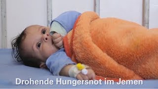 Hunger bedroht Kinderleben im Jemen [upl. by Ramal]