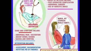 Intestinal Obstruction  Adhesions Intussusception Intestinal atresia and Meconium Ileus [upl. by Ecila538]