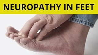 Peripheral Neuropathy Treatment  9 Tips On How to Handle Neuropathy in Feet [upl. by Llekim]