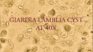 Giardia lamblia cyst under microscope at 40X [upl. by Junius]