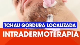 Intradermoterapia [upl. by Giulio]