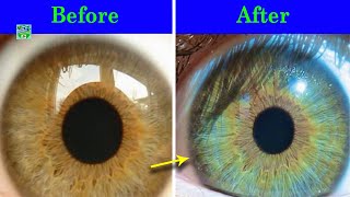 How To Lighten Eye Colour With Honey [upl. by Hairehcaz]