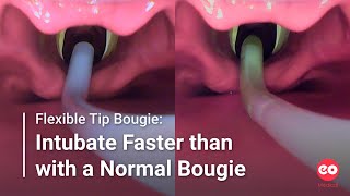 Flexible Tip Bougie Intubate Faster than with a Normal Bougie [upl. by Ahsikahs352]