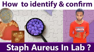 How to identify amp Confirm Staphylococcus Aureus in laboratory [upl. by Laurita]