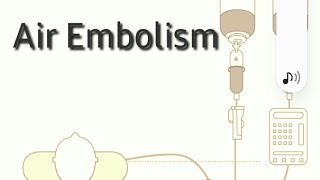 Air embolism [upl. by Sellers]