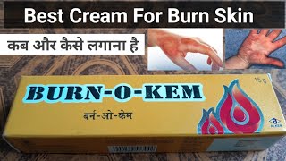 Burn O Kem Cream Antiseptic cream [upl. by Trixy]