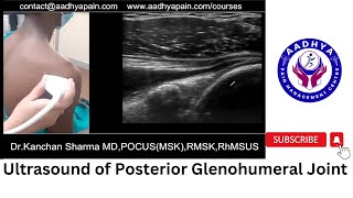 Ultrasound of Posterior Glenohumeral Joint [upl. by Ransome]