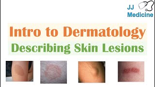 Introduction to Dermatology  The Basics  Describing Skin Lesions Primary amp Secondary Morphology [upl. by Lleder552]