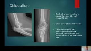 Elbow X ray interpretation in ED [upl. by Devan]