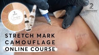 Introducing Stretch Mark Camouflage  a PMU technique [upl. by Naivat]