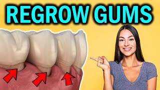 How to Regrow Receding Gums Naturally Reverse Gum Recession without Surgery [upl. by Ylesara2]