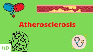 Atherosclerosis Causes Signs and Symptoms Diagnosis and Treatment [upl. by Ecirtael553]