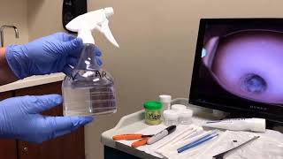 Copy of Colposcopy training video [upl. by Aiyotal]