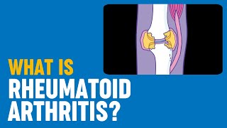 What is rheumatoid arthritis [upl. by Hickey962]