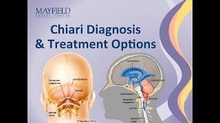 CHIARI MALFORMATIONS RADIOLOGY CT MRI [upl. by Palla47]