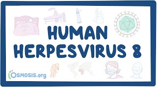 Human herpesvirus 8 Kaposis sarcoma  an Osmosis Preview [upl. by Clarie]