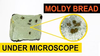 Moldy Bread Magnified Under Microscope [upl. by Delorenzo59]