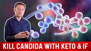 Kill Candida with Keto amp Intermittent Fasting – Dr Berg [upl. by Ahsinel788]