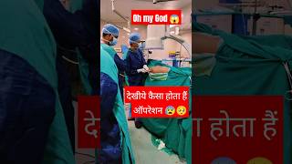 😍Part 4 Femur Nailing surgery 🫣viralvideo orthopedics ytstudio viralshort medic video shorts [upl. by Ahsiatal]