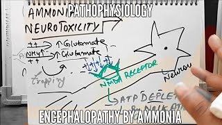 Ammonia Neurotoxicity  Encephalopathy  Pathophysiology [upl. by Feingold]