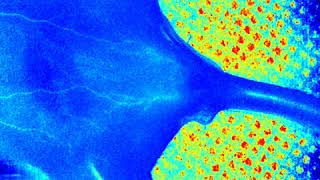 Laser Speckle Contrast Imager System  Pseudo color  Limb 2 [upl. by Sherlocke286]