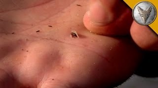 GROSS Baby Leech Burrows Into Coyotes Hand [upl. by Peih]