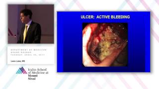 Management of Upper GI Bleeding [upl. by Barolet]