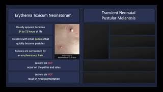 Transient neonatal pustulosis vs erythema toxicum neonatorum Dermatosis of infancy dermatology [upl. by Edin62]