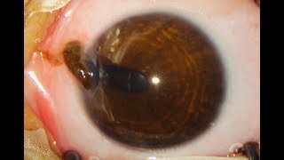 Corneal Laceration Repair Tips amp Pointers [upl. by Mccahill]