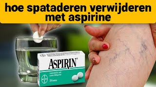 Spataderen verdwenen op de 7e dag neem aspirine en [upl. by Lenneuq]