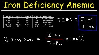 Iron Deficiency Anemia  TIBC UIBC Iron Saturation Transferrin amp Ferritin [upl. by Snapp809]