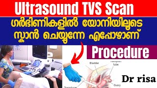 Pregnancy Last Scan Report Malayalam  9 Month Scan [upl. by Renado619]