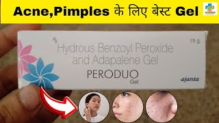 Peroduo Gel Use in Hindi  Benzoyl peroxide amp Adapalene Gel Use  Acne  pimples  SK MEDICINE [upl. by Geraint]