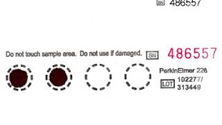 PKU Blood Sampling [upl. by Newby]