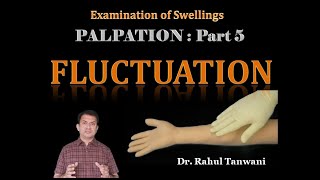 Palpation of Swellings  Part 5  Fluctuation [upl. by Ahsenrac]