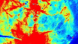 RWD Laser Speckle Contrast Imager Cortical spreading inhibition [upl. by Kirch160]