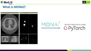 MONAI What is it and how is it accelerating the adoption of AI in Medical Imaging [upl. by Houghton]